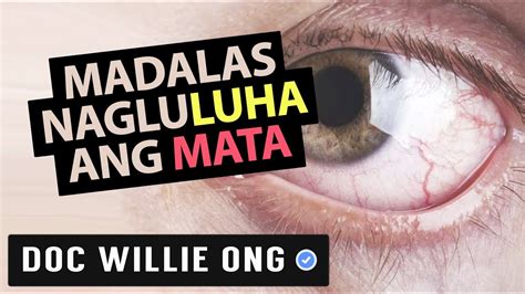 Madalas Nag.